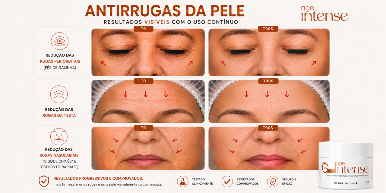 Antirrugas da pele — resultados visíveis com uso contínuo (rugas periorbitais, da testa e nasolabiais em T0 e T90s)